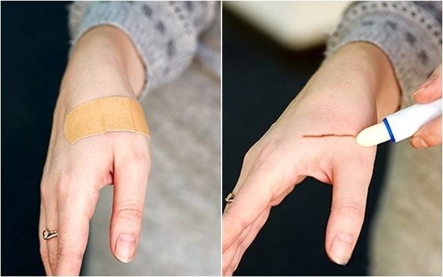 오래된 립밤 활용법 상처 벌레 물린곳