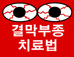 결막부종 치료법