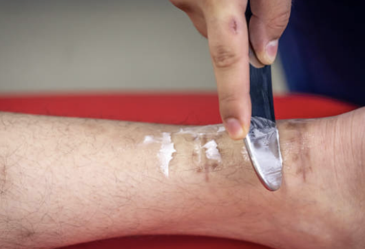 피부건조증 증상, 치료법, 좋은 음식과 연고 등 소개