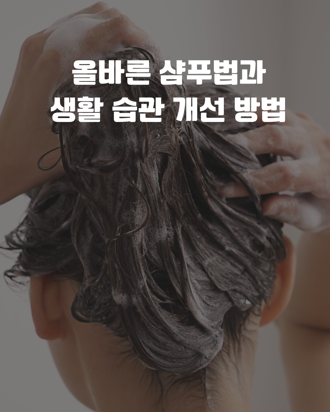 두피 여드름과 헤어라인 여드름 발생 원인 및 올바른 샴푸법과 생활 습관 개선 방법을 설명하는 피부 관리 정보 그래픽
