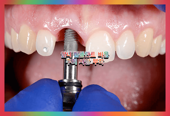 앞니 임플란트 치료