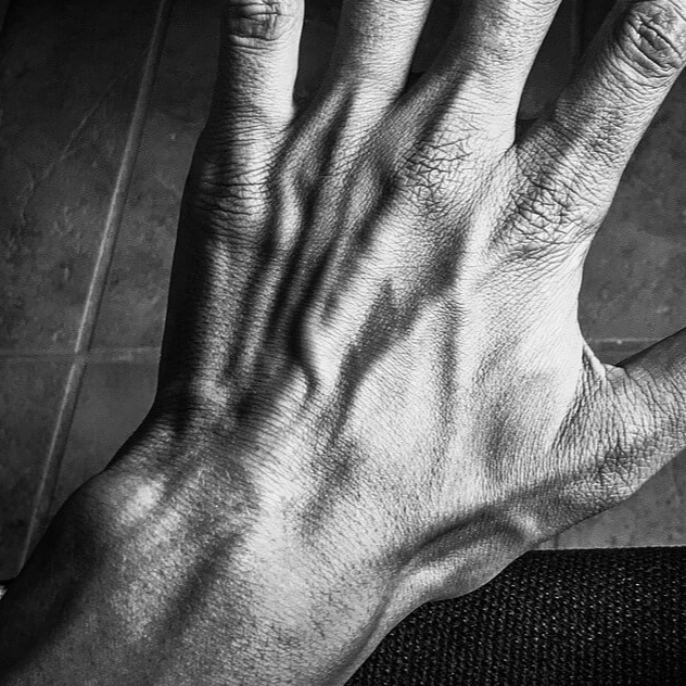 단단한 혈관을 표현