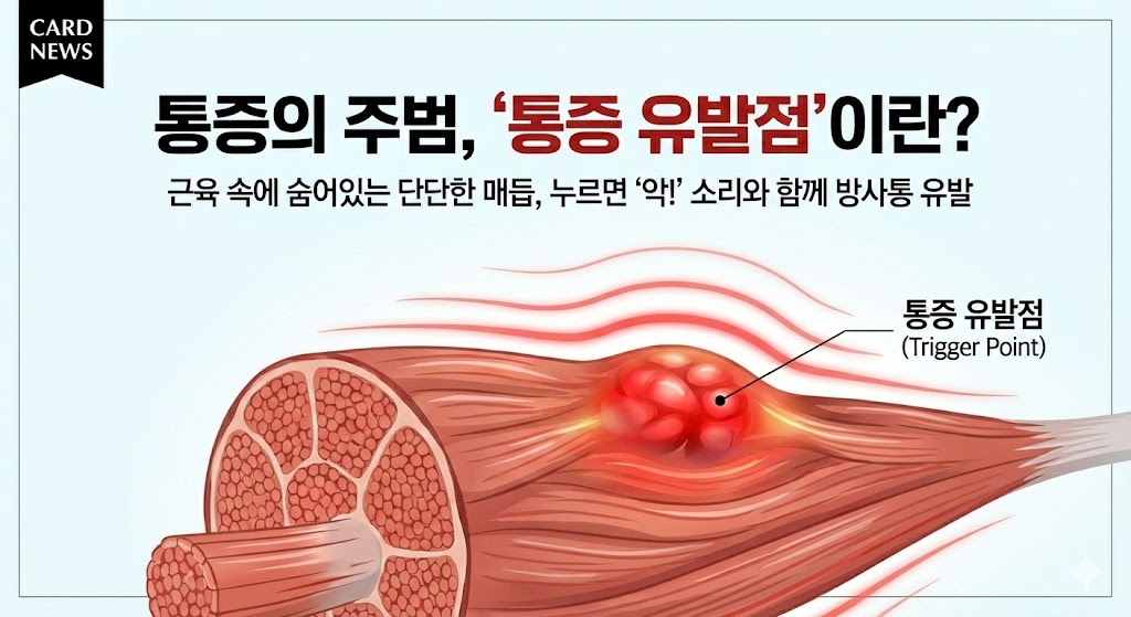 근막통증증후군
