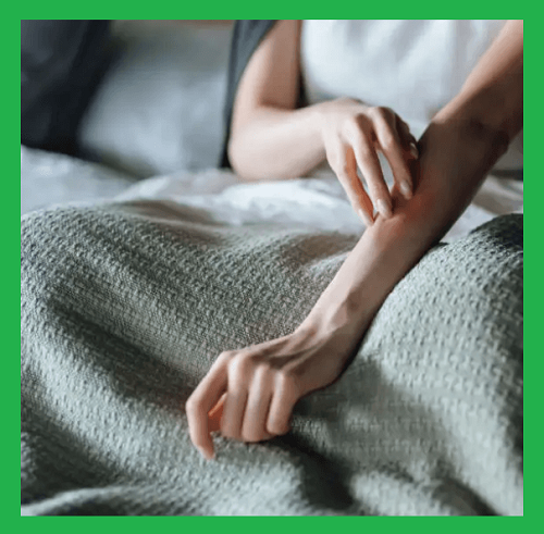 알레르기-가려움