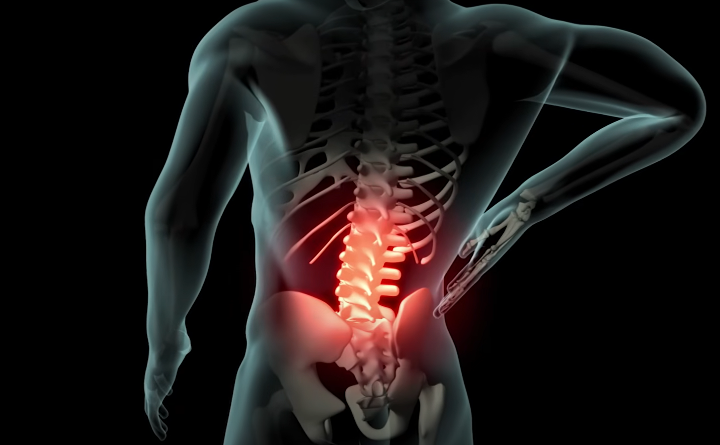 허리통증 이미지