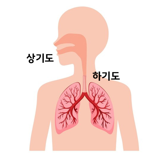 기관지염