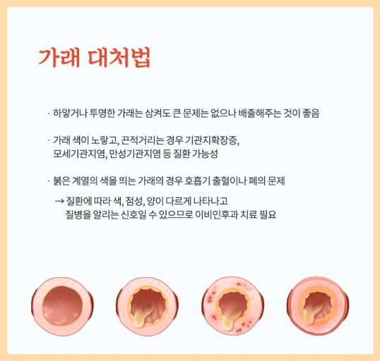 호흡기 질환: 가래- 생기는 원인, 색깔별 증상과 질병, 대처법과 가래 없애는 법.