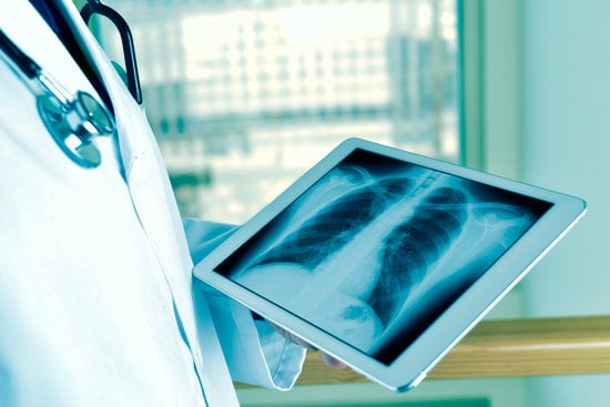 흉부 외상(Thoracic Trauma): 원인, 증상 및 치료