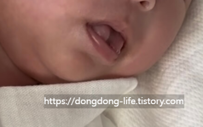 아기 사진