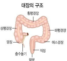 젊은 대장암 관련 이미지