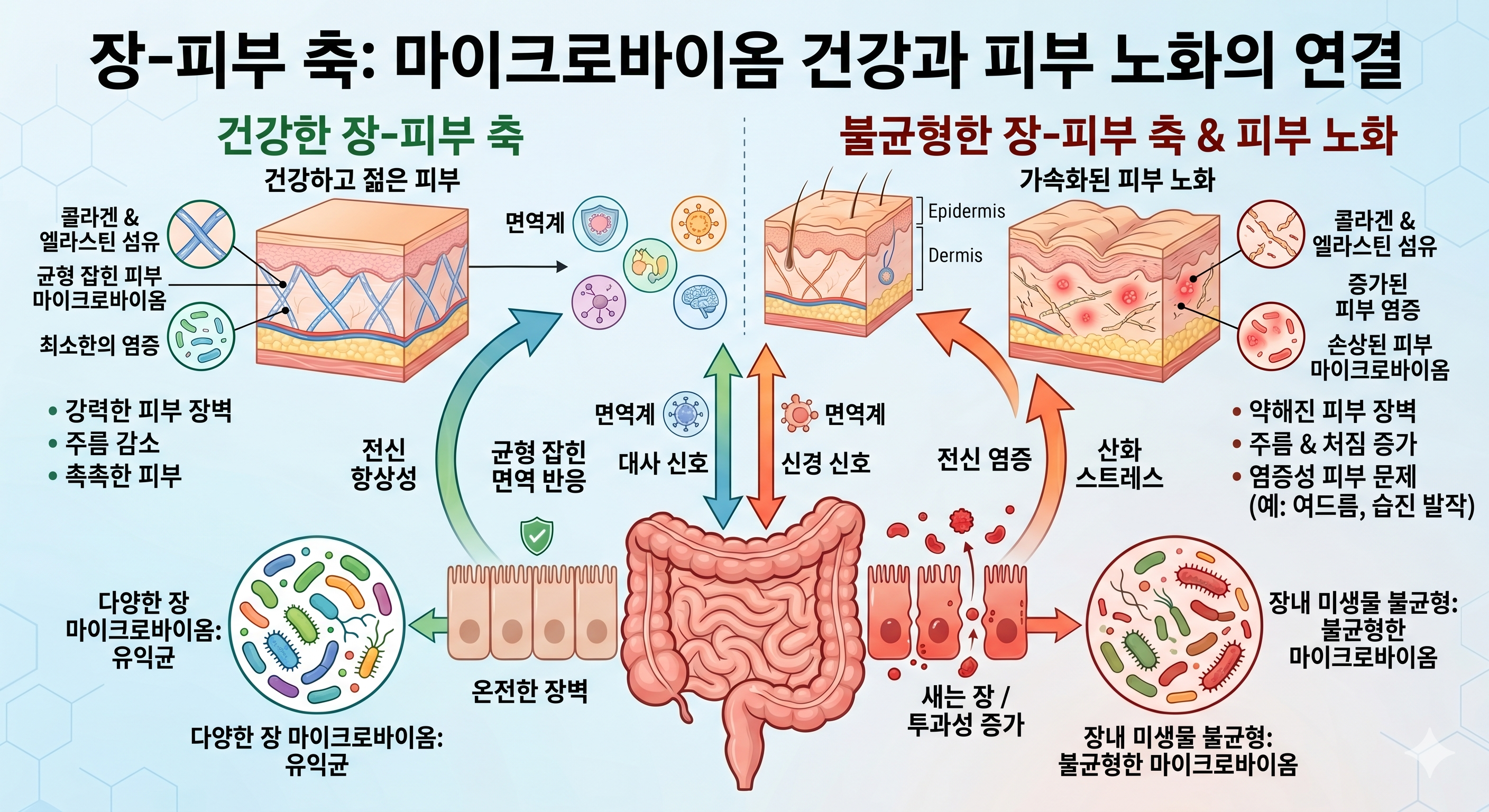 장-피부 축 마이크로바이옴 &mdash; 장 투과성 LPS 전신 염증 피부 노화 프로바이오틱스 예방 전략
