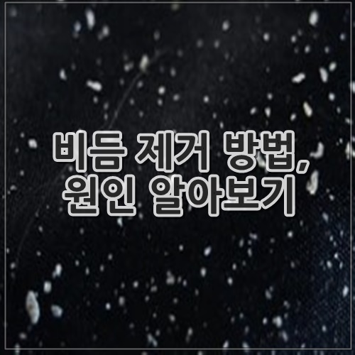 비듬 제거 방법, 원인 알아보기