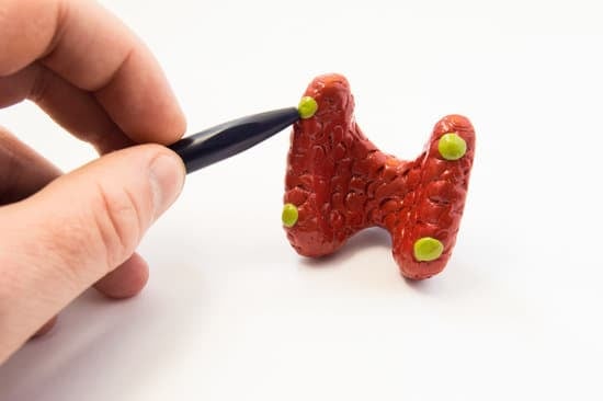 부갑상선항진증 (Hyperparathyroidism)의 치료