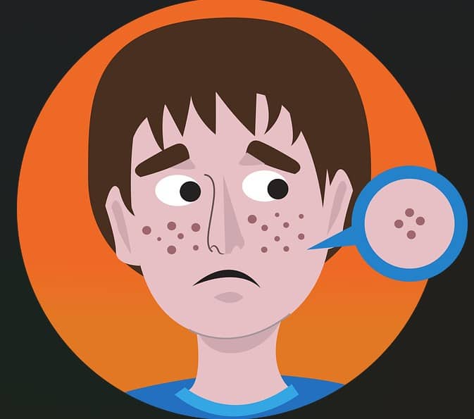 평편사마귀란? 원인과 증상