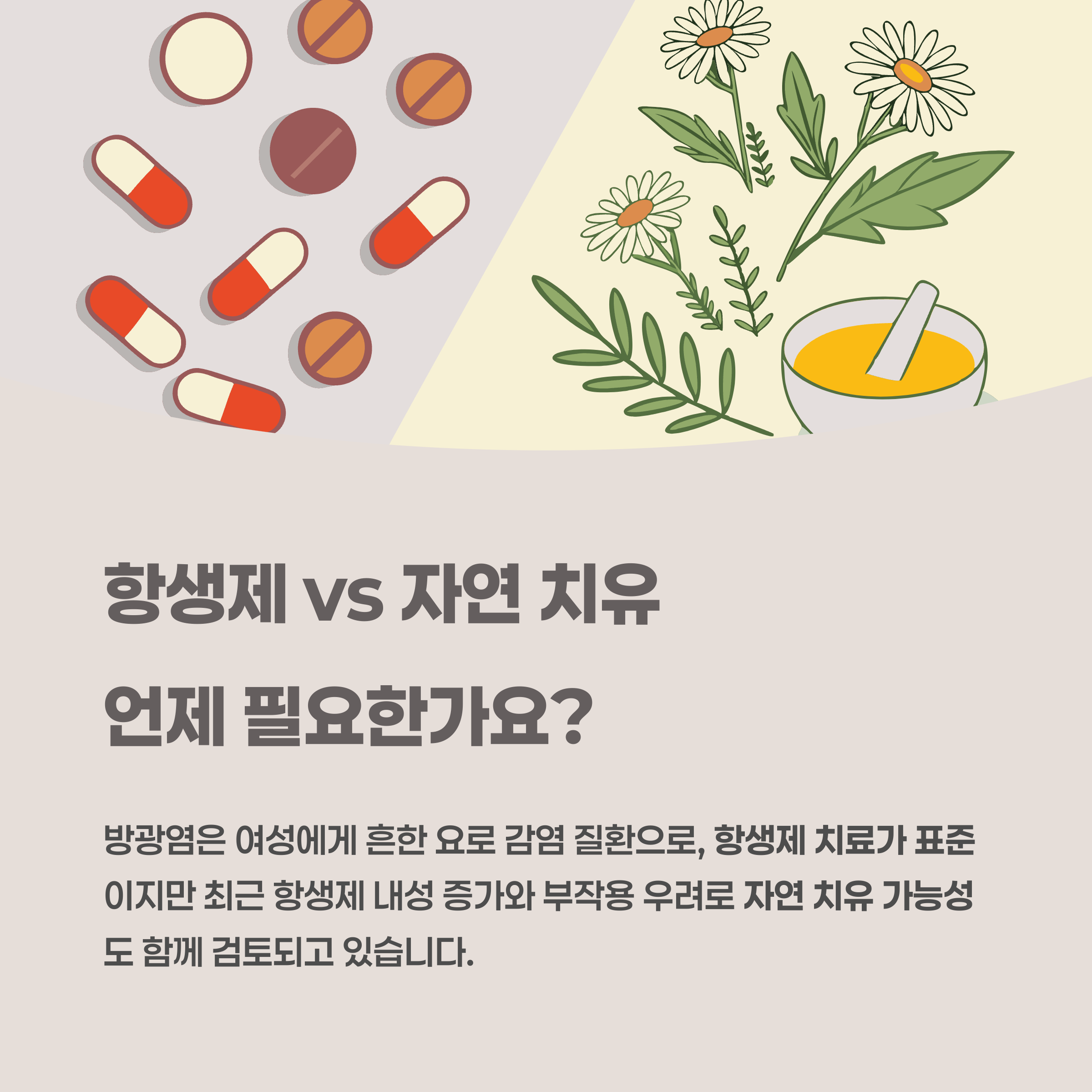 언제 항생제가 꼭 필요하고, 언제 자연 치유가 가능한가요?