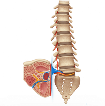 척추 협착증 초기 증상 및 원인3