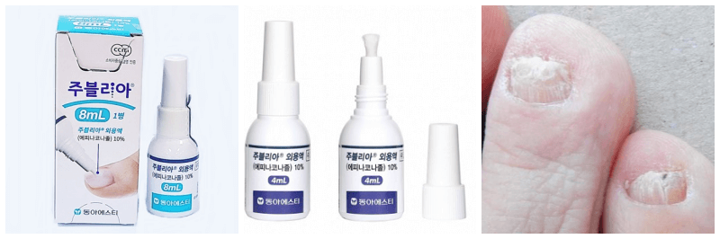 주블리아 외용액, 무좀 사진