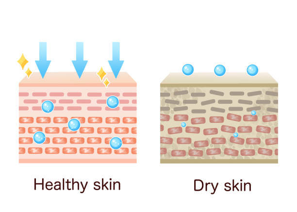 건성 피부 (Dry Skin)