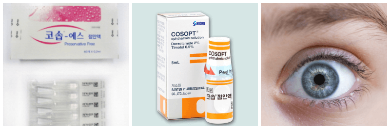 코솝에스점안액, 코솝점안액, 녹내장 사진