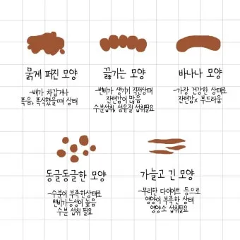 검은 변 원인 위장 출혈 가능성 있는 소화기 질환 정리_28
