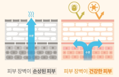 민감성 피부 관리법