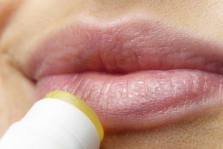 입술포진-예방법-보습관리