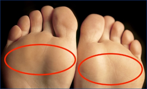 메타타살지 과부하