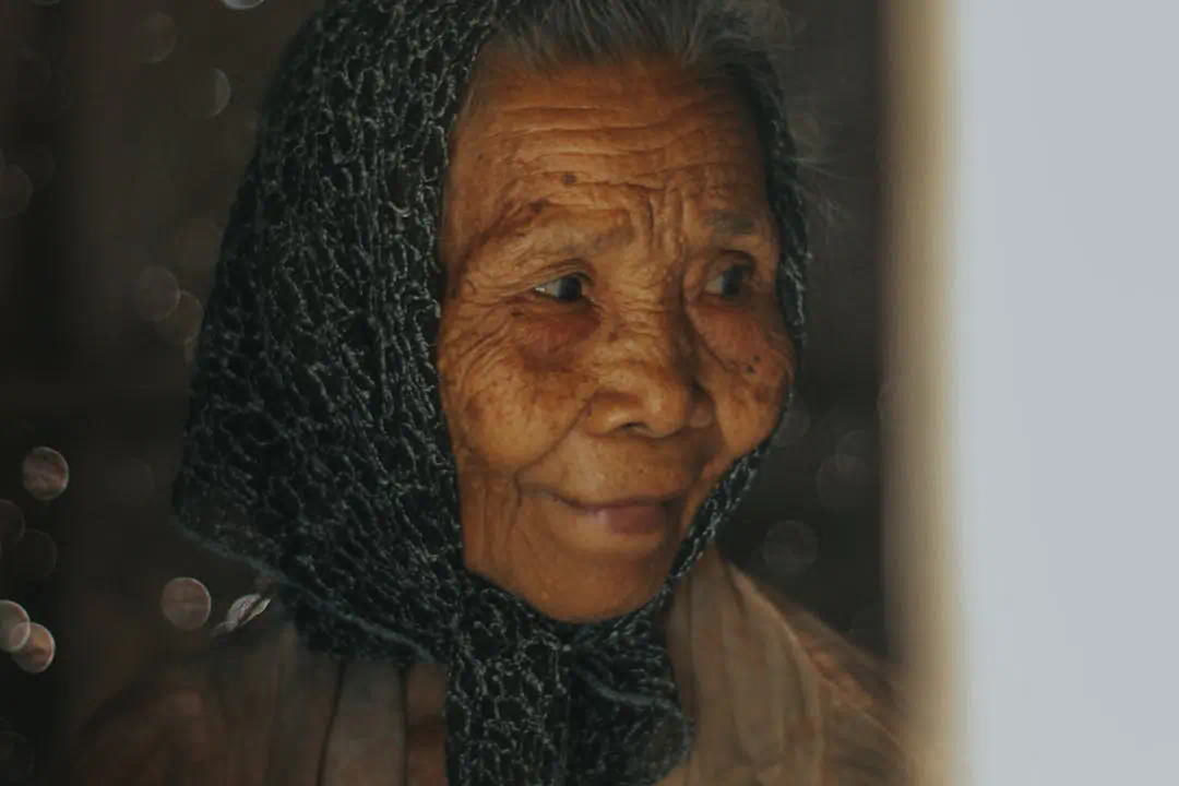 검버섯에 취약한 노인 여성의 사진2