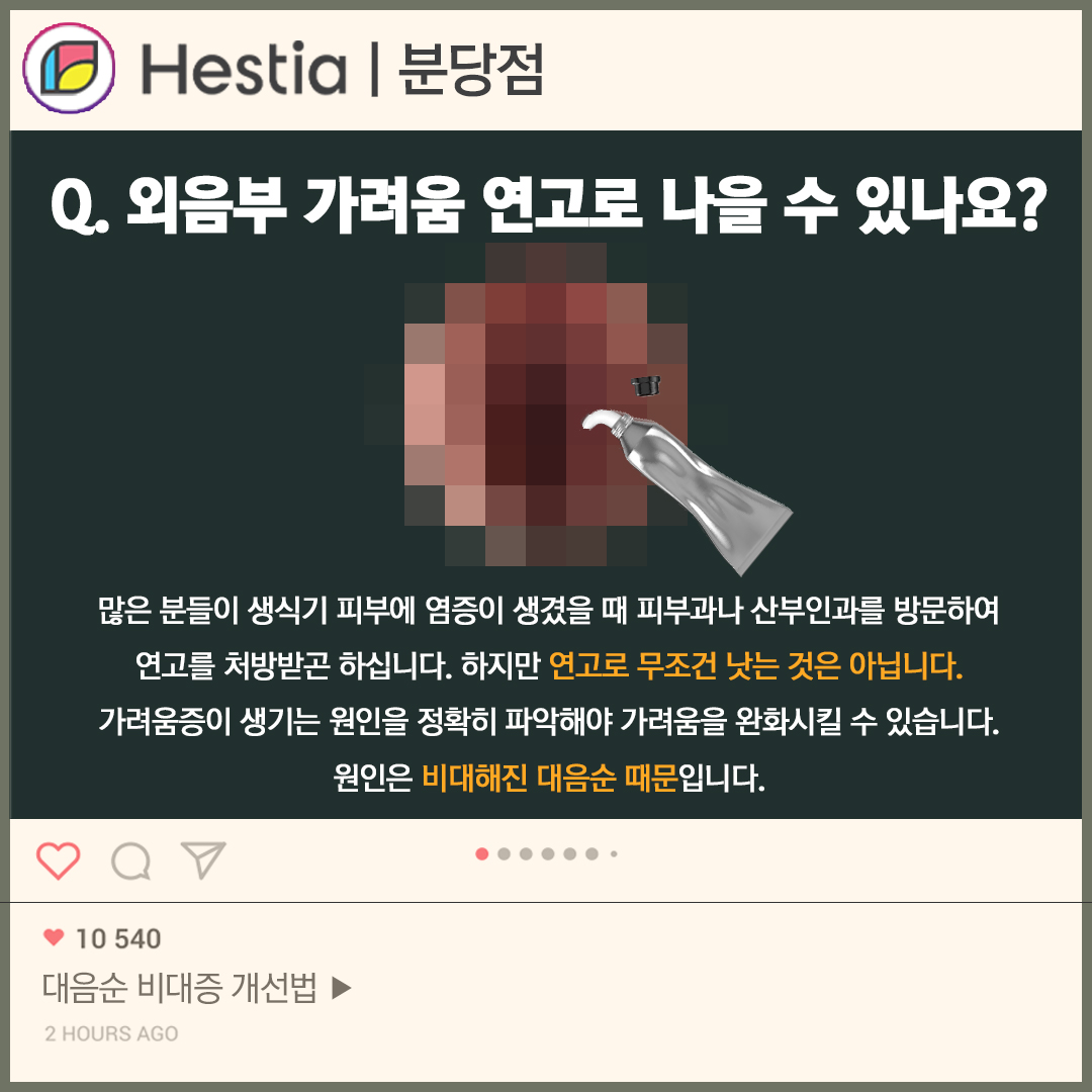 생리 후 가려움 외음부 가려움 연고 대음순 비대증 외음부 가려움 연고도 소용 없어요..