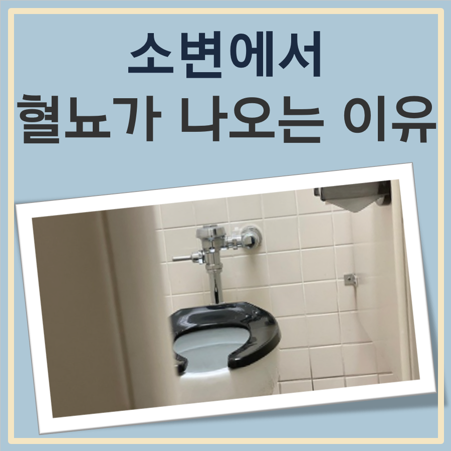 소변에서혈뇨가 나오는 이유