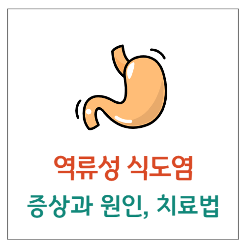 역류성식도염 증상, 치료 방법