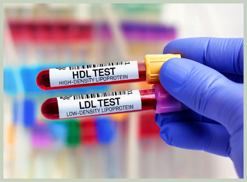 hdl 콜레스테롤 높이는 방법