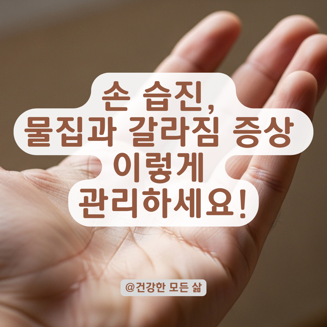 손에 물집 생기고 갈라질 때, 반복되는 습진 증상 관리법 총정리.