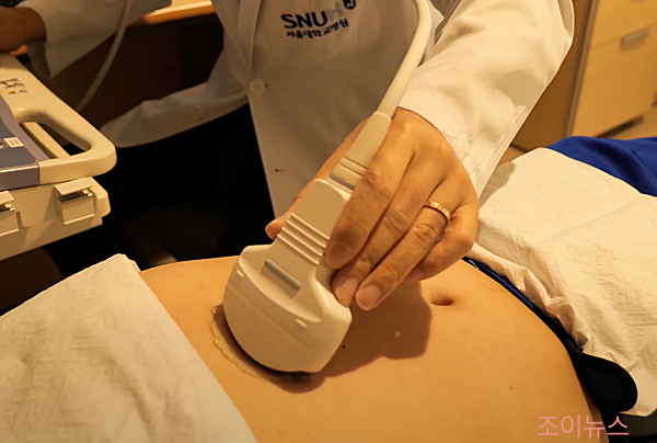 초음파검사_서울대병원tv