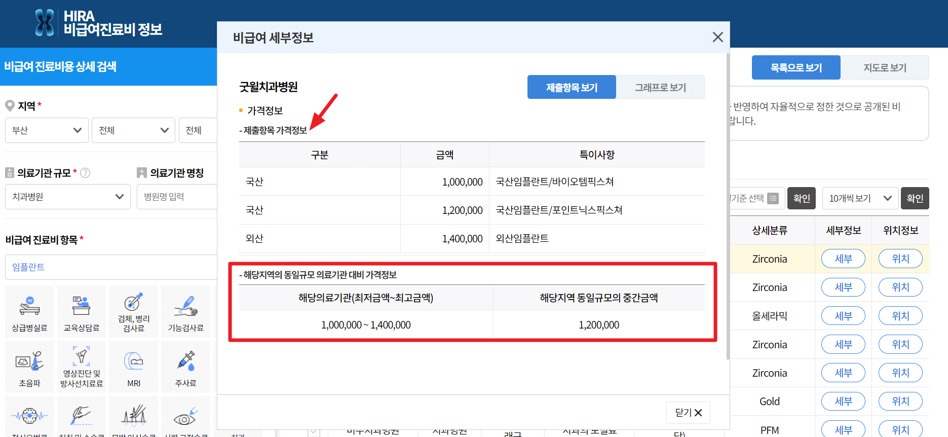 임플란트 가격 비교 건강보험심사평가원 모두닥 가격 비교 사이트 확인 방법