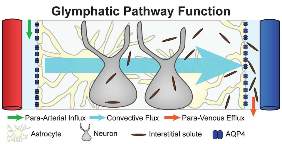 뇌 노폐물 배출관, 글림프 시스템, 알츠하이머와의 관계