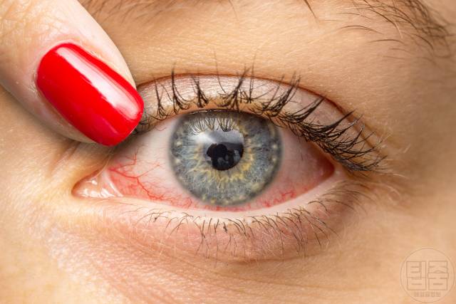 스마트폰 중독 증상 휴대폰 중독 증상 부작용 노안 안구건조증