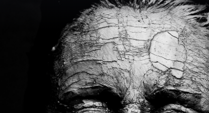 코엔자임큐텐 부작용 : 피부