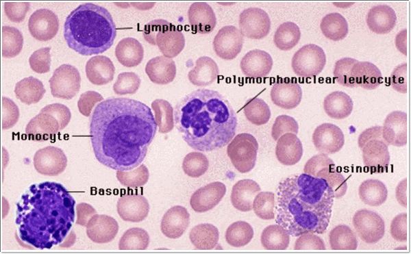 혈소판 수치가 낮으면