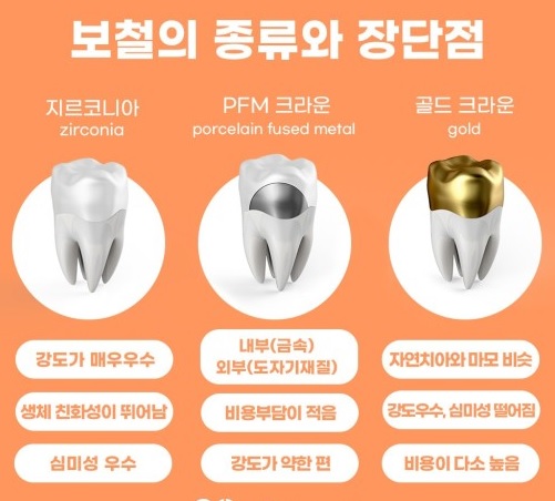 임플란트 보철의 종류와 장단점