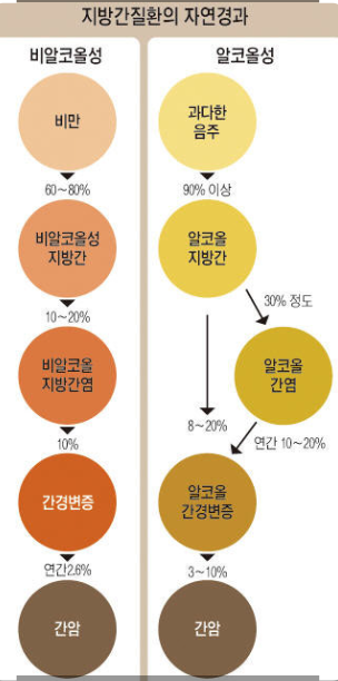알코올성 간질환과 비알코올성 지방간 관련 사진