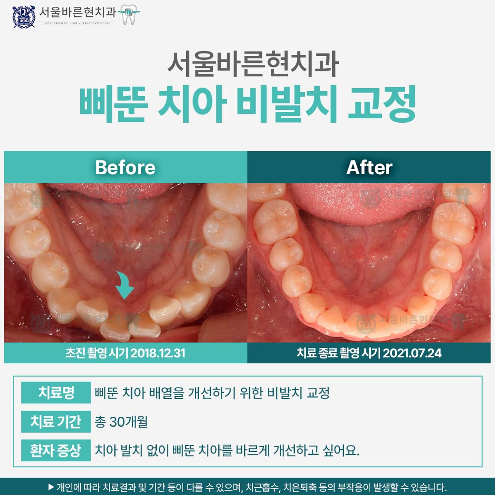 부산교정치과