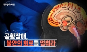 공황장애