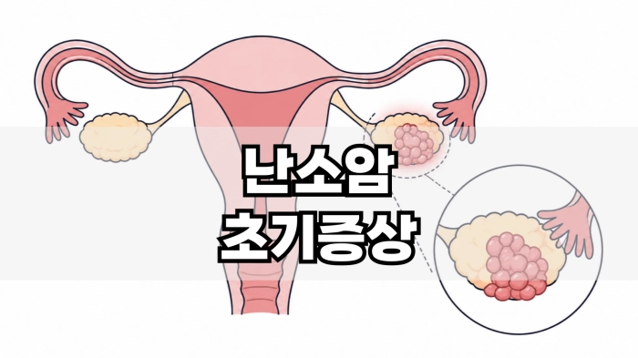 난소암 초기증상