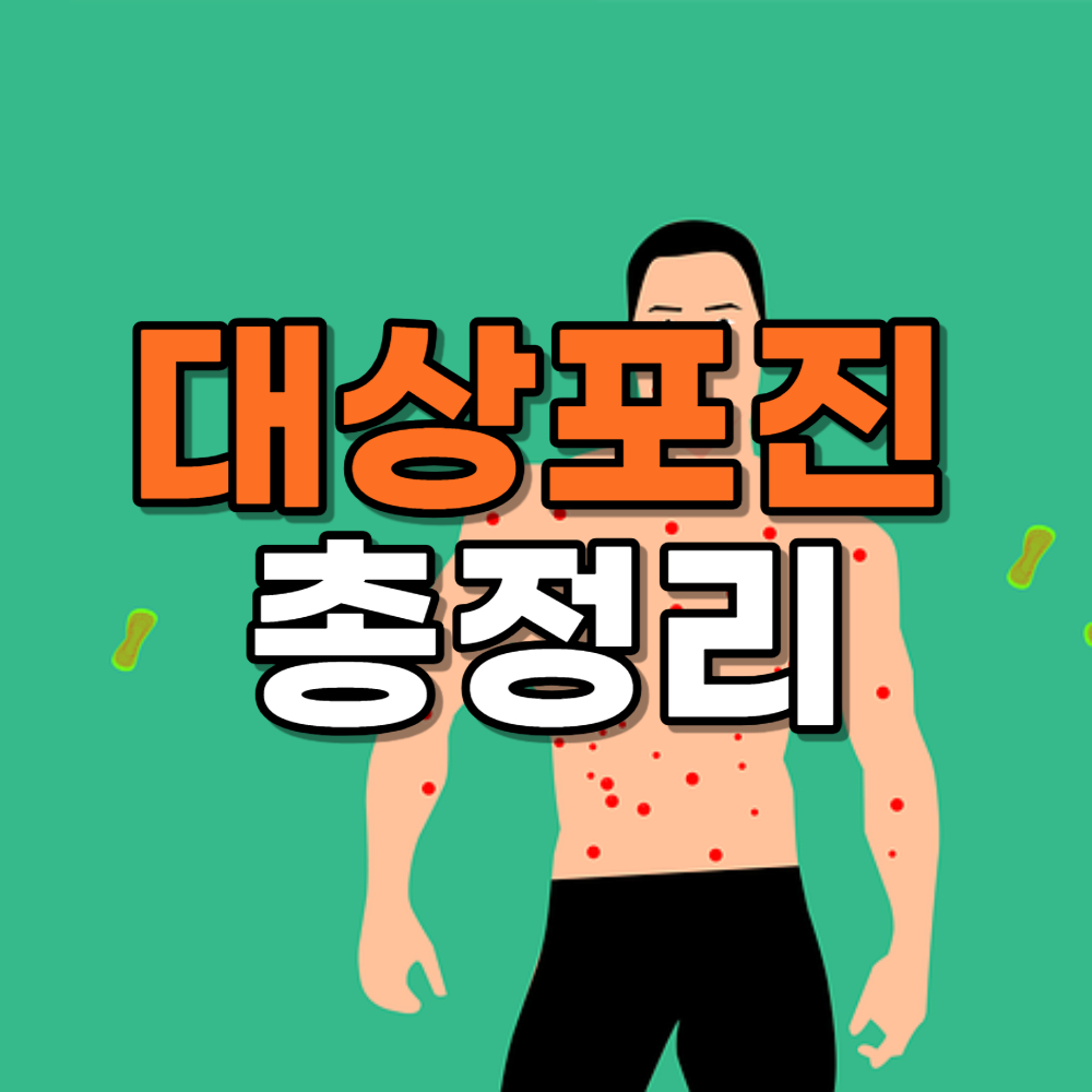 대상포진 걸리는 이유, 전염, 빨리 낫는 법, 예방법
