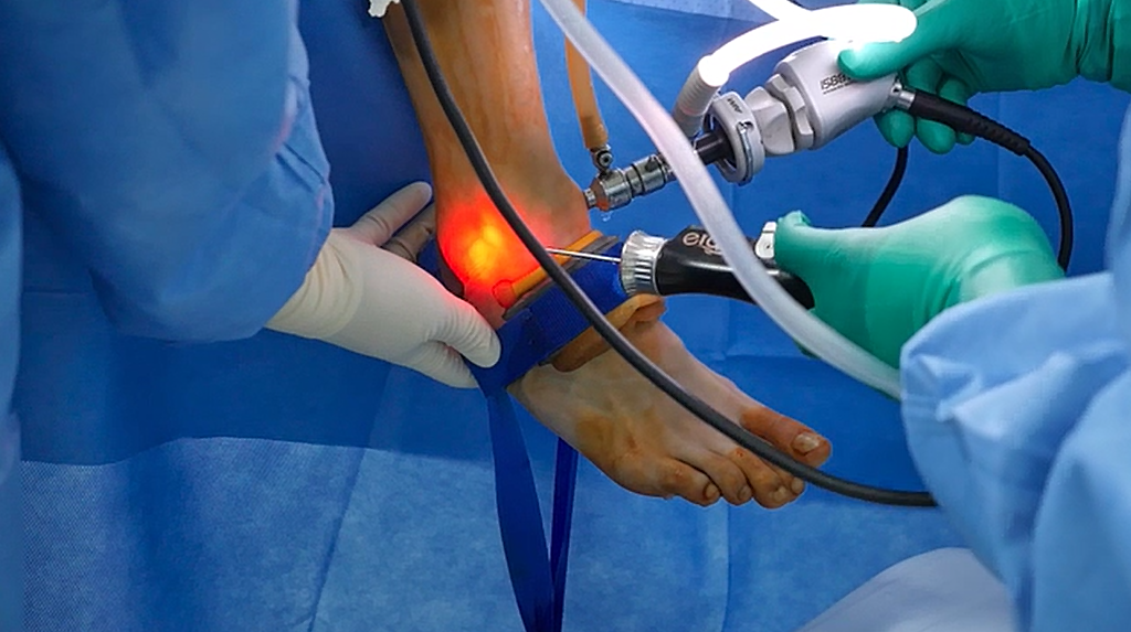 명의 발목 관절