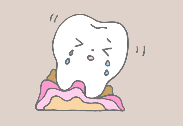 잇몸이-내려앉은-모습