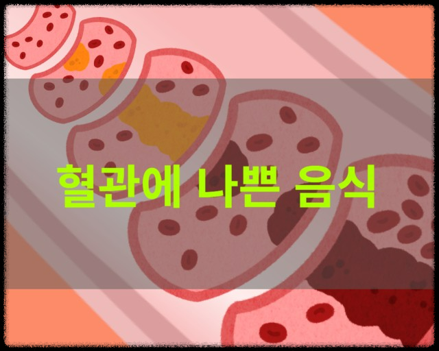 혈관에 나쁜 음식