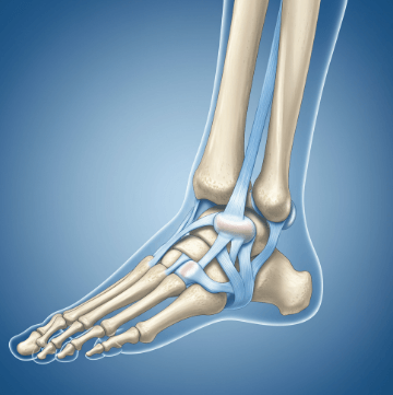 발목 관절염 초기 증상 체크1