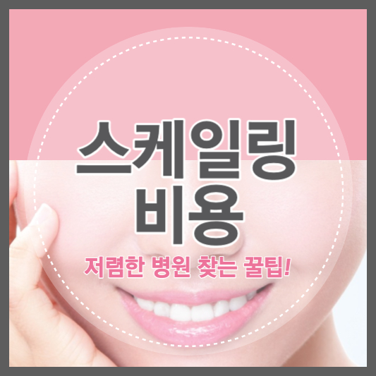 스케일링 비용 가격